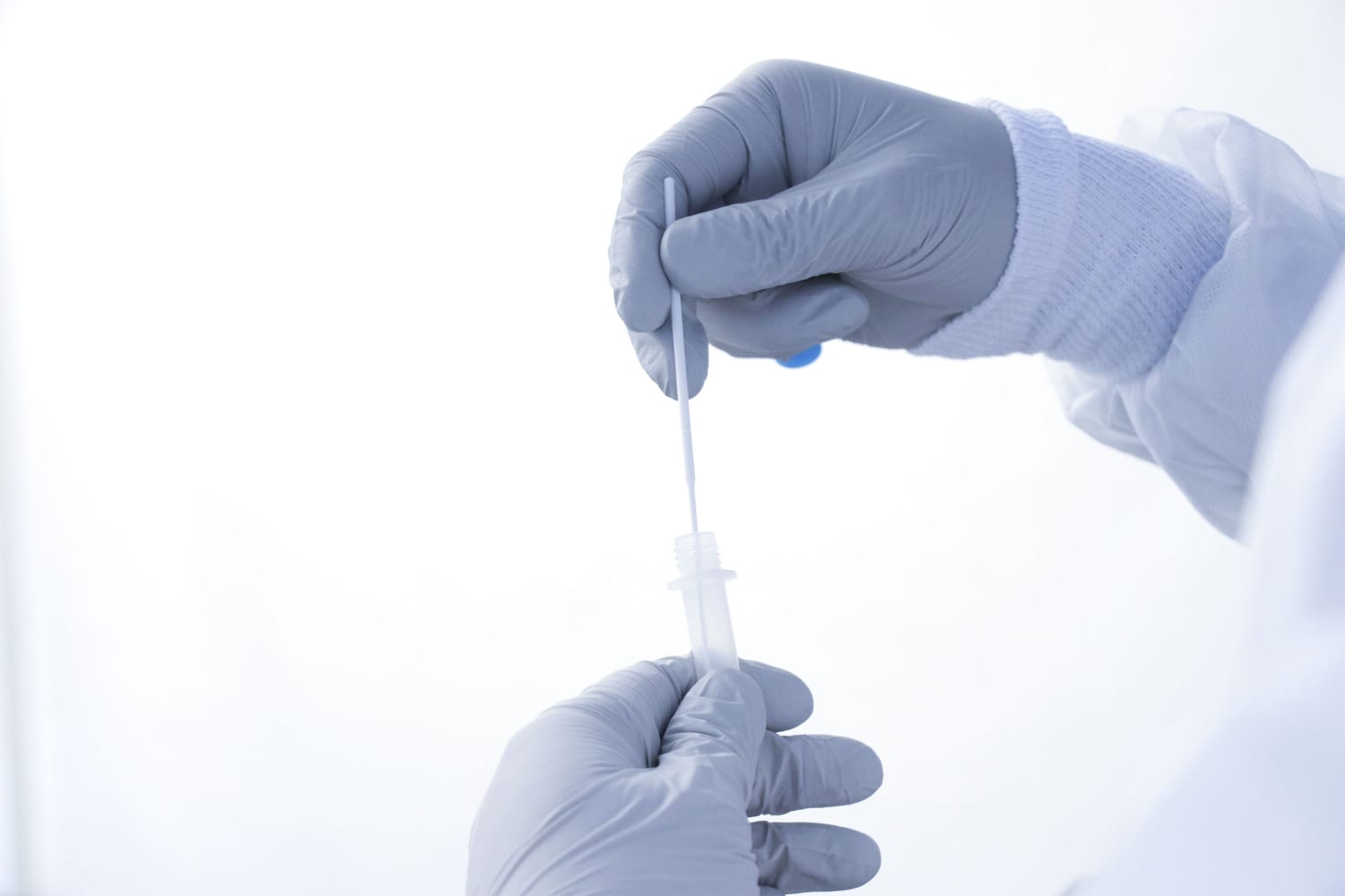 Atiende Secretaría de Salud 17 personas hospitalizadas por COVID-19, hubo una defunción