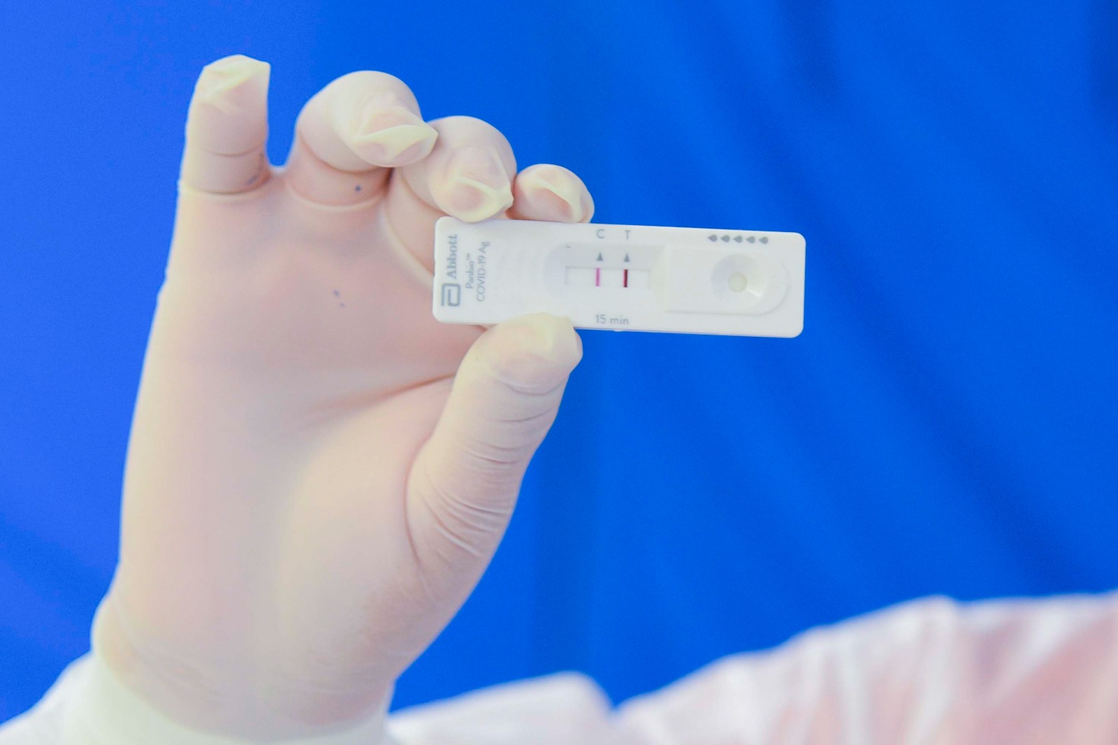 Registra Puebla 20 casos activos de COVID-19: Salud