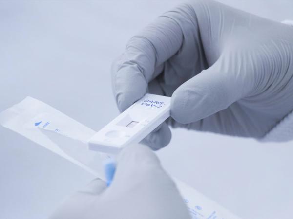 Reportan dos fallecimientos por Covid en las últimas 24 horas