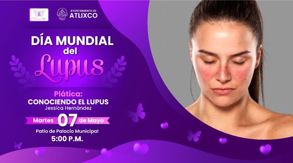 Lupus1