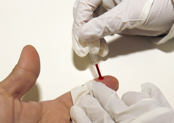 Desarrollan inmunoterapia para revertir daño cardíaco debido al colesterol