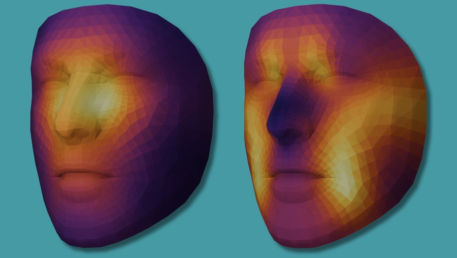 El Reconocimiento Facial Con Ia Podría Ayudar A Personalizar Tratamientos Contra El Cáncer